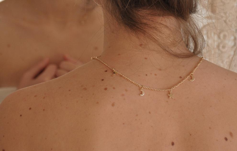 Cancer-de-Piel-Prevencion-Lunares